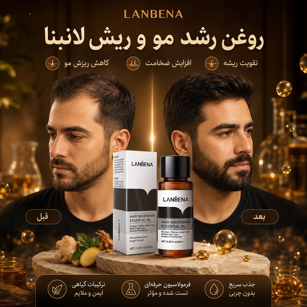 روغن رشد مو و ریش لانبنا LANBENA